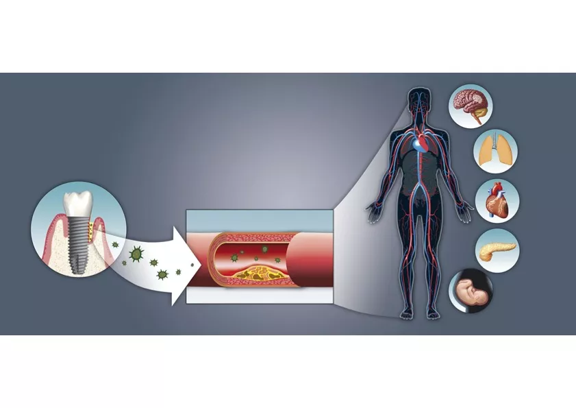 Biocompatibilité